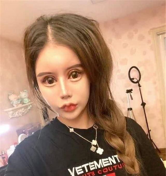 人间|13岁女孩为变漂亮,3年整容60次成小网红,自称是人间芭比