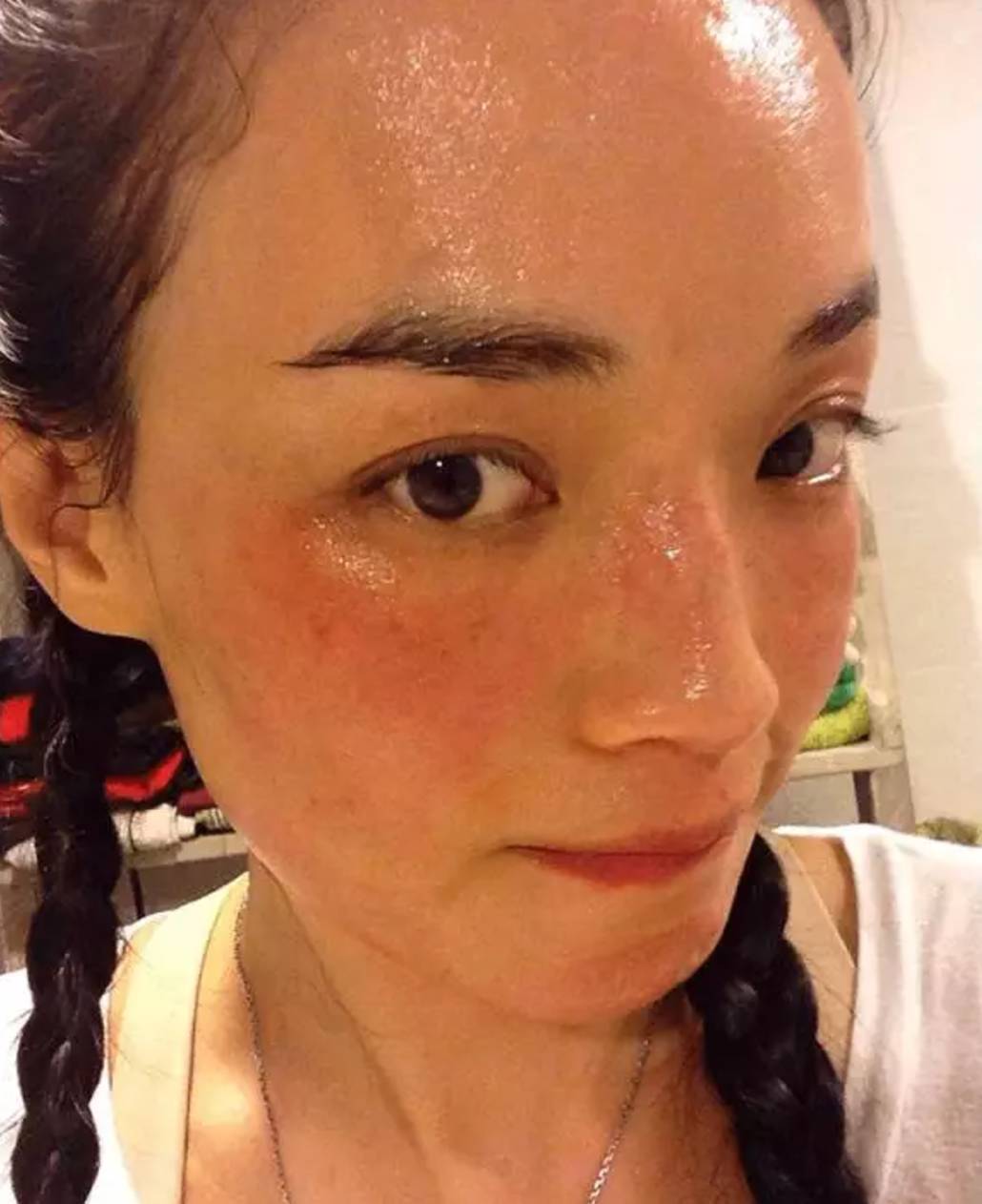 痘痘|如何养出女明星那样细腻的好皮肤？最关键是做对这7点，全教给你！