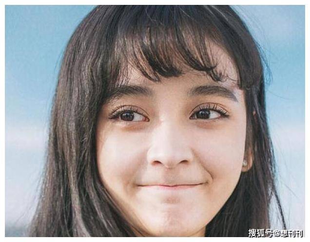 角色|这6个明星天然脸长得跟整容似的，这种痛苦和烦恼谁不想有？