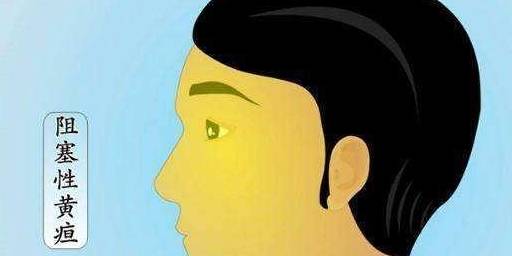 男人怎么变得精力充沛 987342453ac9441fb1ecb15a9bbcafb9.jpeg