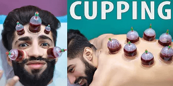 文化|这届老外，终于知道拔罐的秘密了？