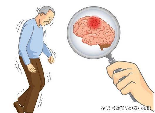 症状|一人脑梗,全家遭殃!这3个脑梗“祸源”最好远离