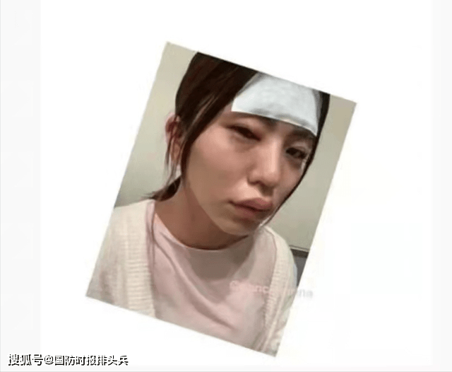 医疗|印度出现“神秘”热病，日本莫德纳疫苗异物揭秘，越南疫情蔓延