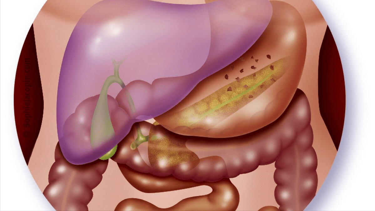 植物|它是肝细胞的“修复器”,一种植物泡水喝,能提高肝功能