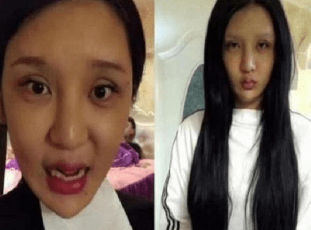 因为|花费400万整容200多次，最后却沦落到坐轮椅，还险些切除一器官！