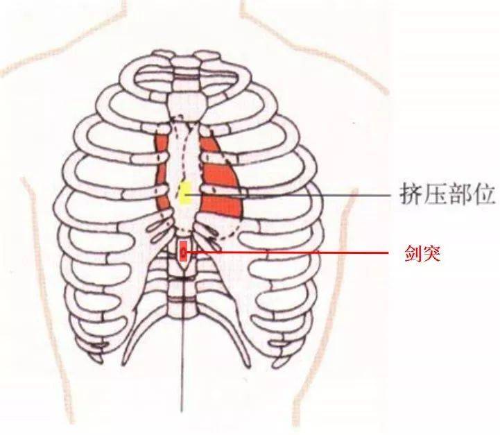 的位置一般位于上腹正中或偏右,胃溃疡疼痛,多位于剑突下正中或偏左
