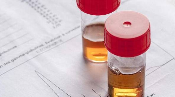 严重|得肾病五年只有尿潜血，算严重吗？应该如何治疗？