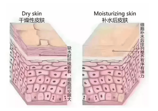 方法|皮肤干痒是缺水吗？教你正确补水护肤方法，恢复水嫩嫩的脸