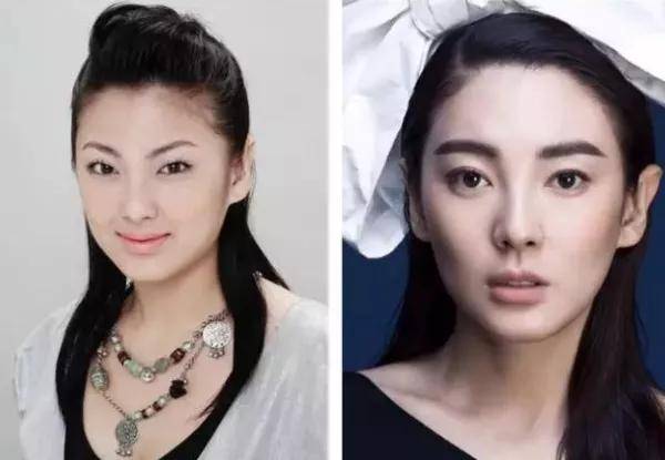 因为|姐妹，双眼皮再好，咱也别硬割啊！