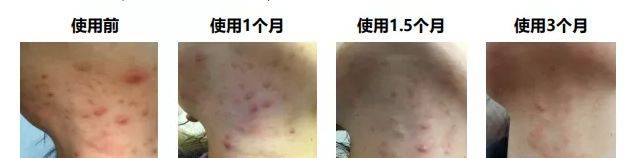 产品|被拉进黑名单的护肤品有哪些？口碑好但巨难用，风再大也不要买