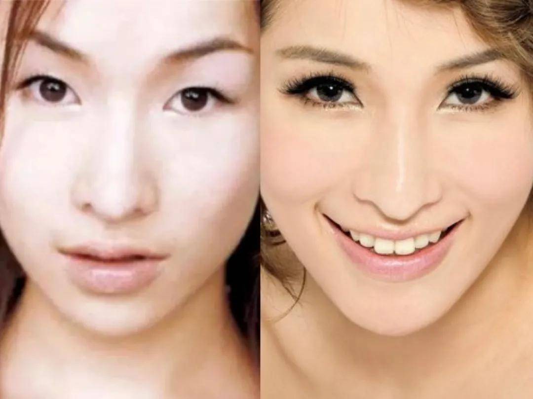 因为|姐妹，双眼皮再好，咱也别硬割啊！
