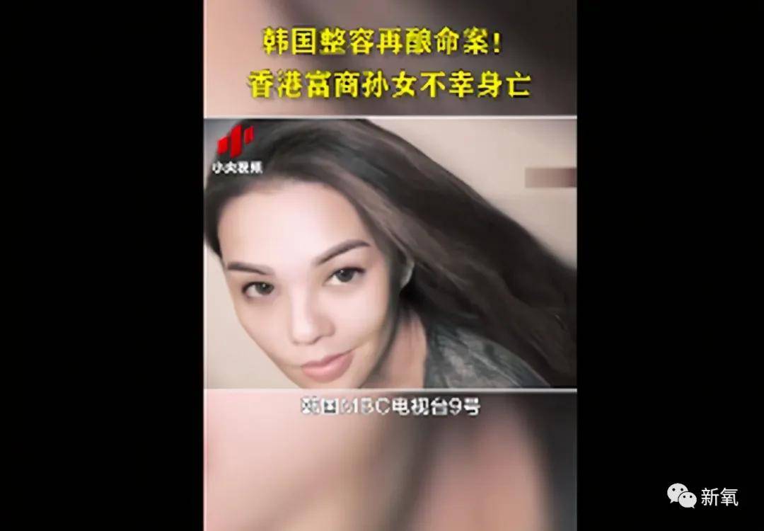 效果|孔雪儿怎么肿成这样？这是填充失败了吗？！