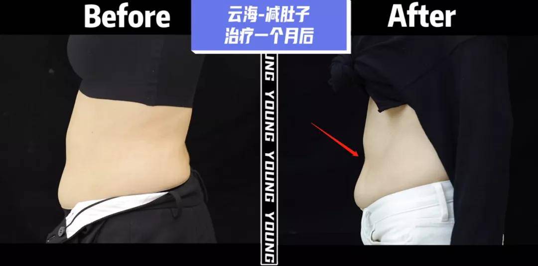 效果|孔雪儿怎么肿成这样？这是填充失败了吗？！
