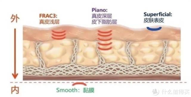 蛋白|fotona4d副作用太吓人还有救吗？