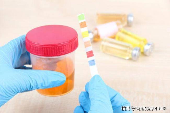 药品|肝不好的人，早上起床可能有6种表现，建议及时做个肝功