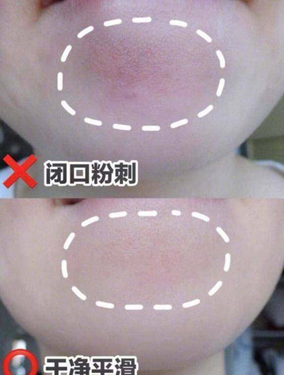 宋轶|宋轶“好皮肤”被赞,大方分享护肤经验,竟和赵露思用同款护肤品
