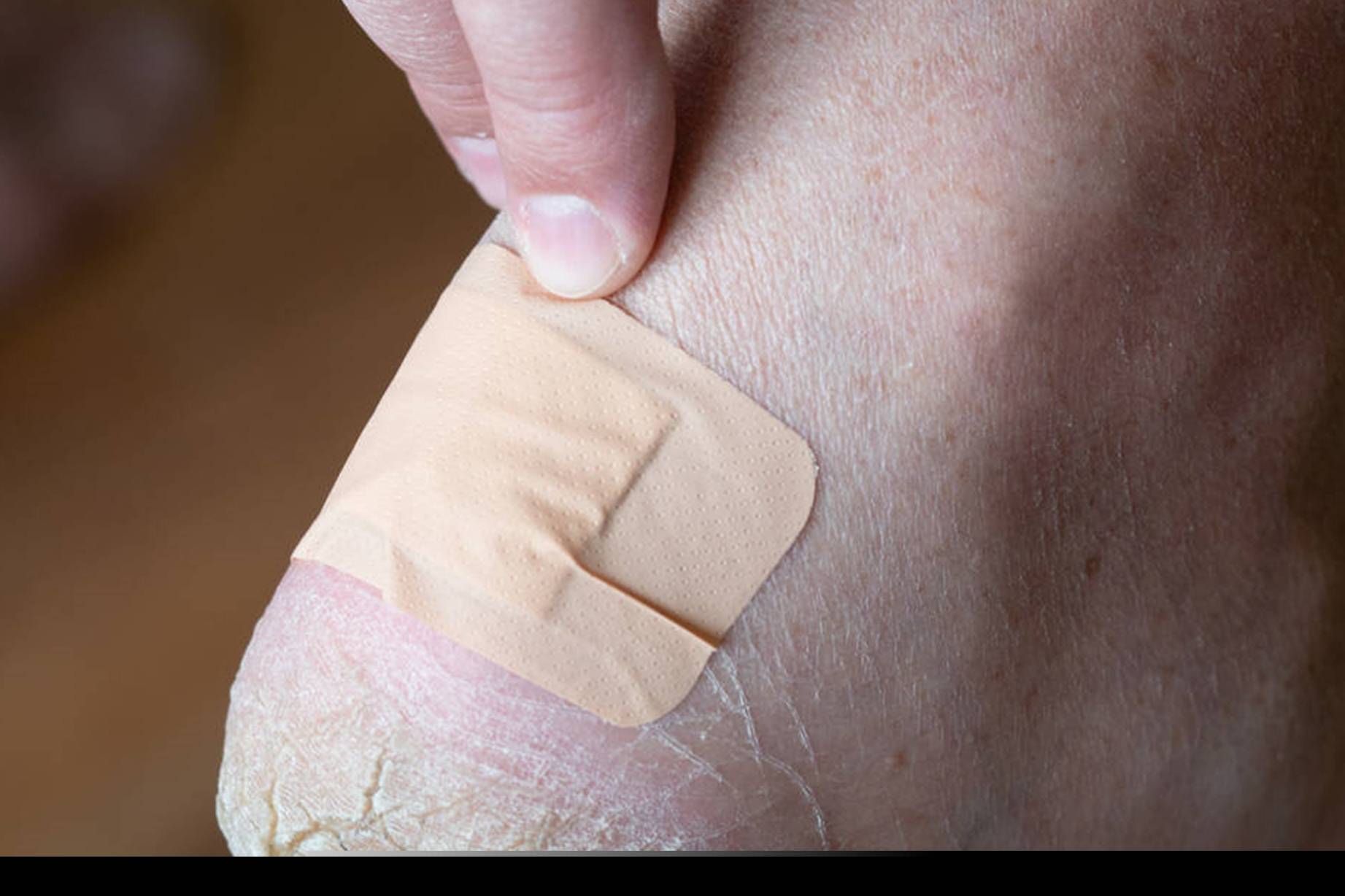 肝脏|若脚上出现3个信号,肝已“脆如纤维”,尽早自查,切勿不可逆!