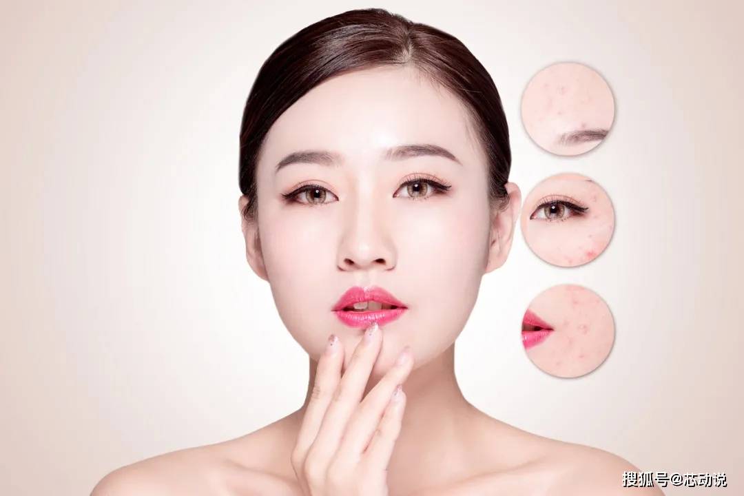 疗法|“微针疗法”到底是什么？关于这4点一定要了解清楚