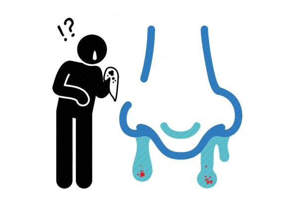 肝脏|面部出现4个“异象”，需及时就医检查，这多半是肝病上身的信号