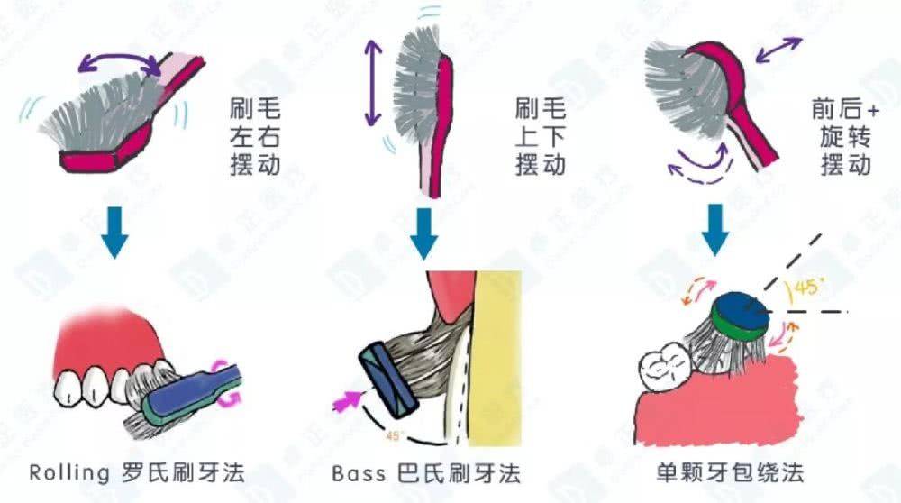 什么时候刷牙最合理 82318544b33d4631b25daa30e4730eb2.jpeg