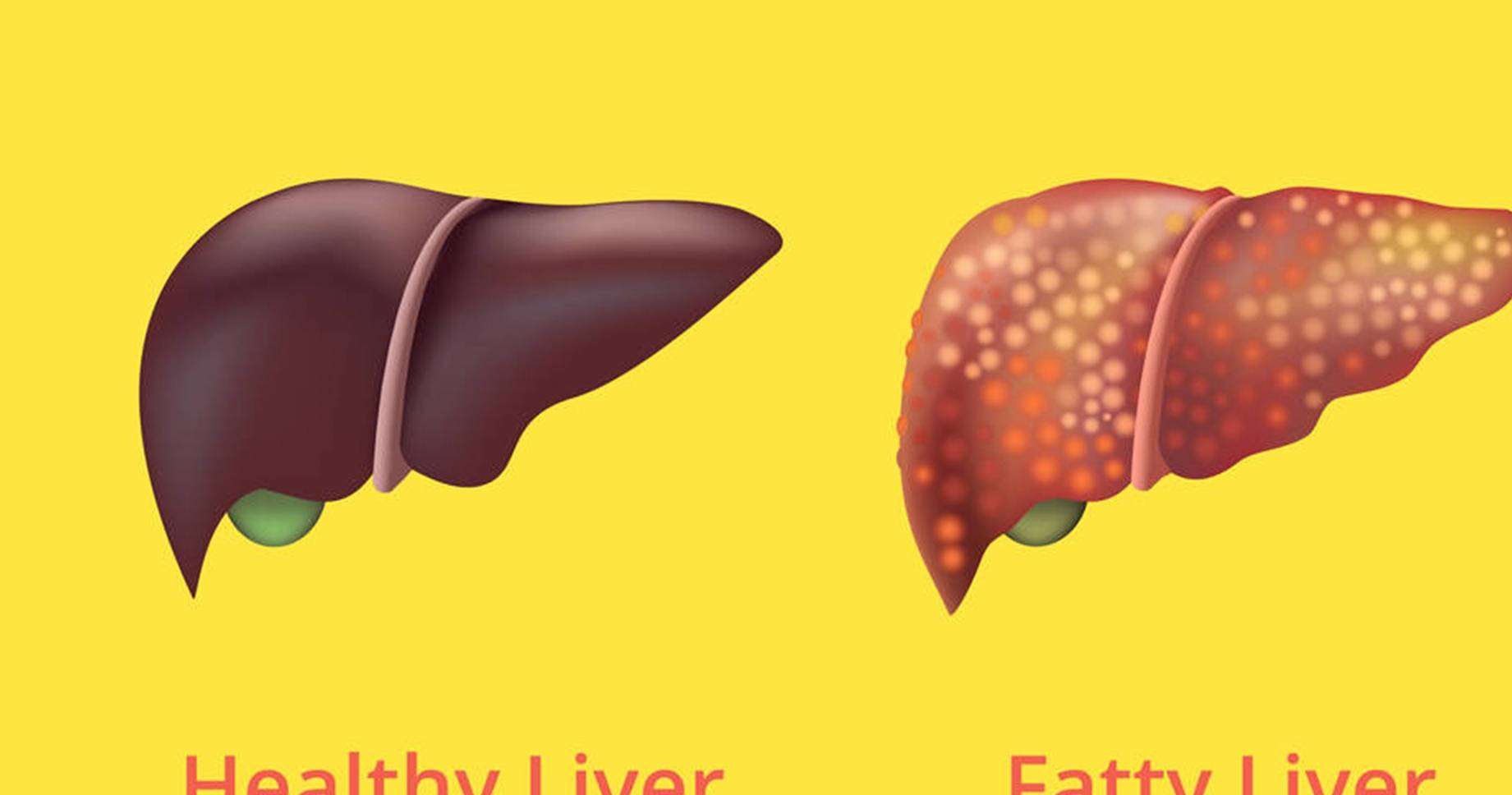 饮食|误以为皮肤过敏，却查出肝硬化，提醒：皮肤1处异常多是肝脏病变
