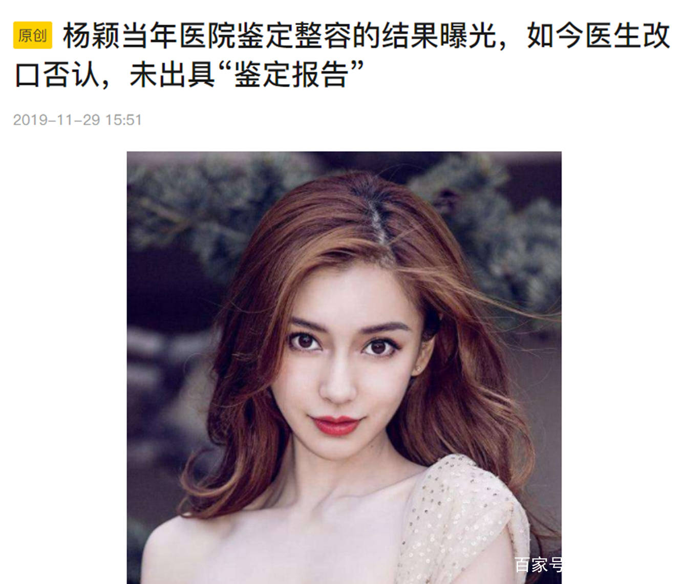 隆穹|太尴尬了!盘点8位明星“改头换面”后车祸现场,都是灾难(下)