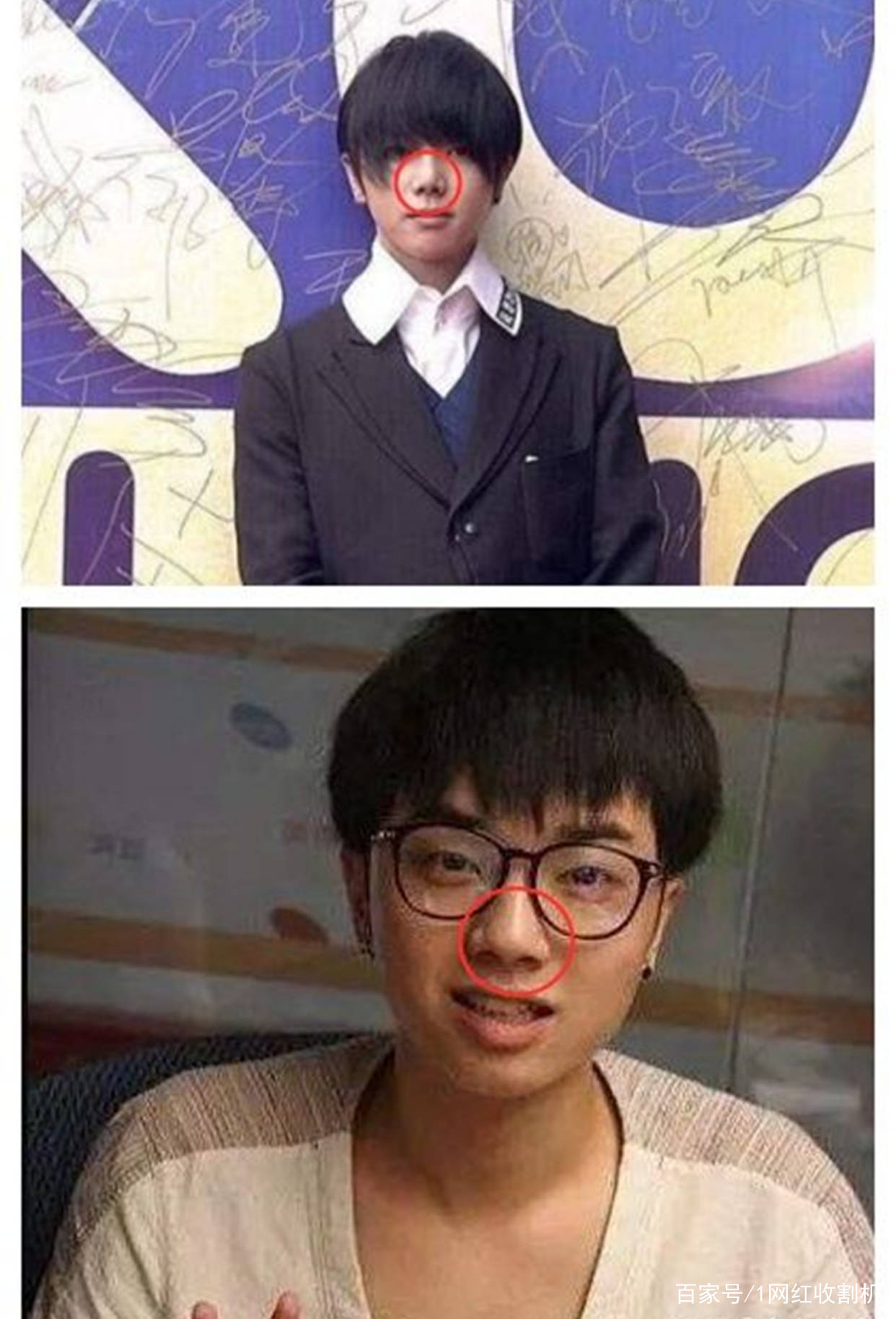 隆穹|太尴尬了！盘点8位明星“改头换面”后车祸现场，都是灾难（下）