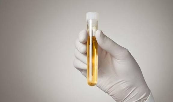 睡眠|糖尿病怎么样做血糖好？五个控血糖的基本原则要清楚