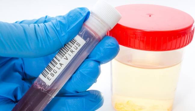 尿液|肾病好转，4项尿液指标会发信号，若都有先恭喜你