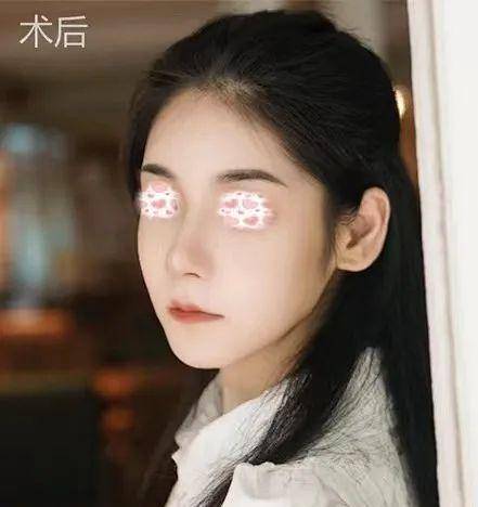 丑是真|她他们的鼻子到底丑在哪儿？