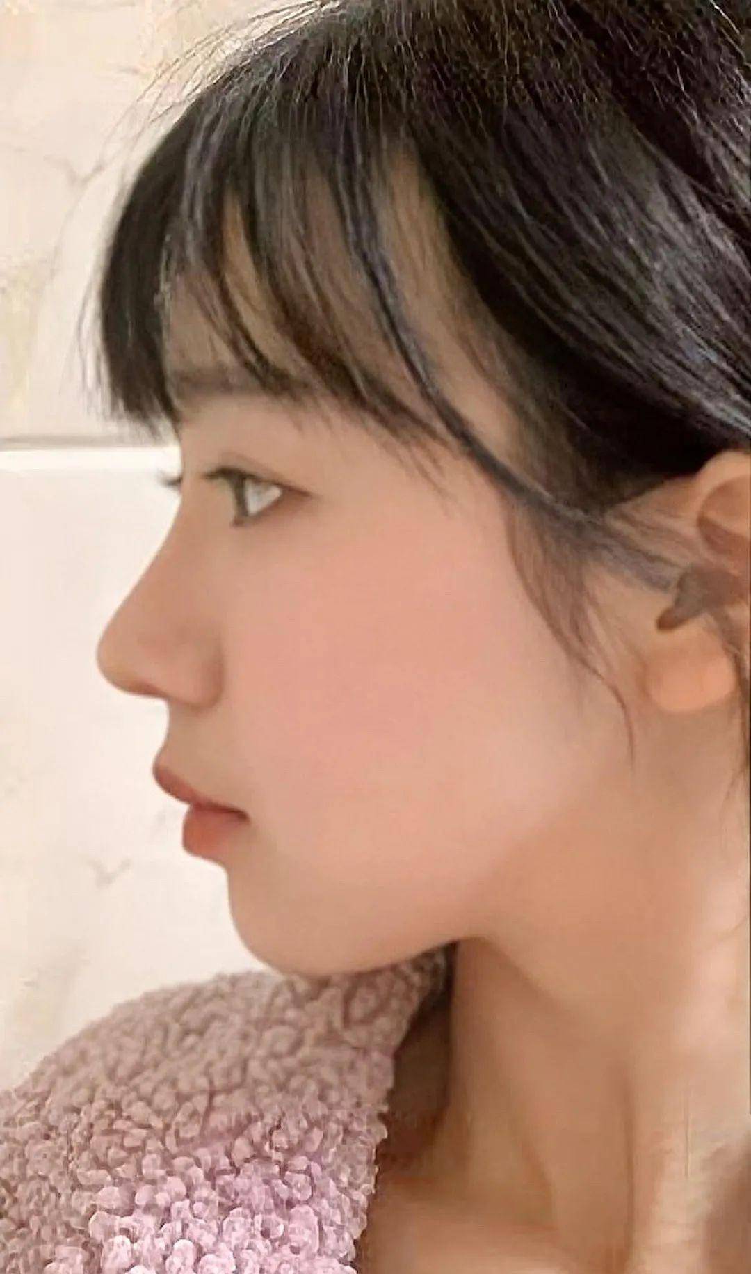 丑是真|她他们的鼻子到底丑在哪儿？