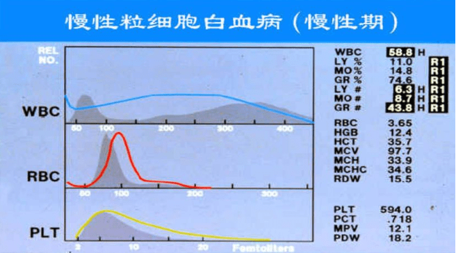 血液分析仪的检测原理及临床应用