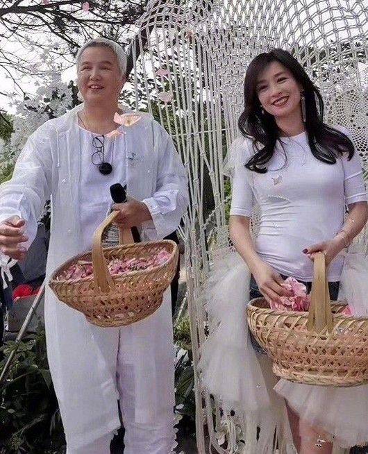 头发|张庭直播意外曝光真实脸，法令纹深重发腮明显，是老阿姨！