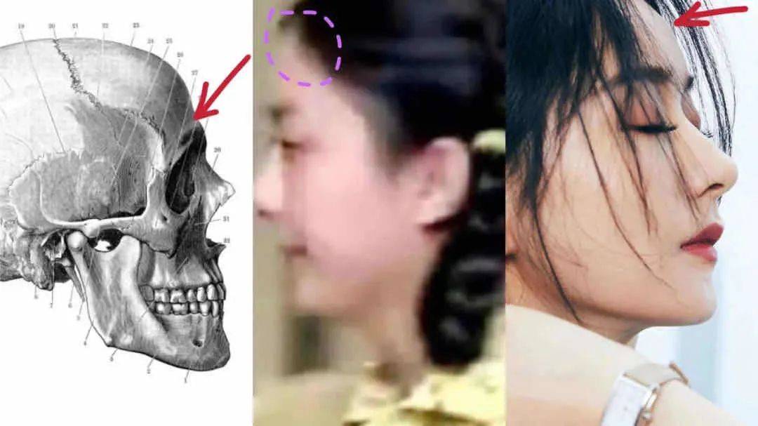 小天|救命!南韩吹炸天的大美人,这双眼皮是用菜刀do的吗…