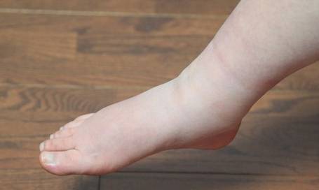 肾脏|身体出现这4个“红色信号”，或许是慢性肾衰竭“前兆”，别大意