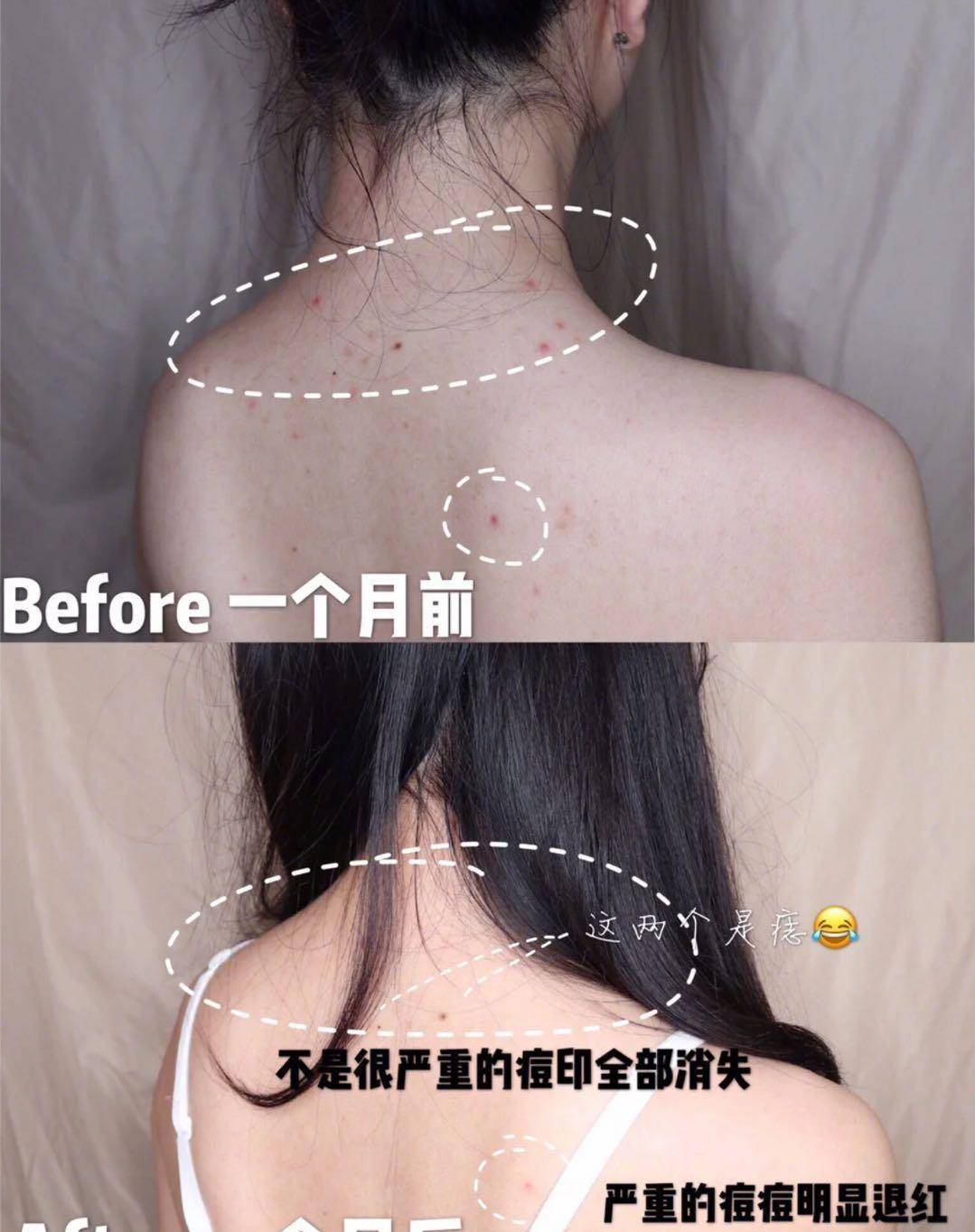 黑头|金晨是牛奶“泡大”的？穿吊带裙藏不住“水光肌”皮肤嫩得要出水