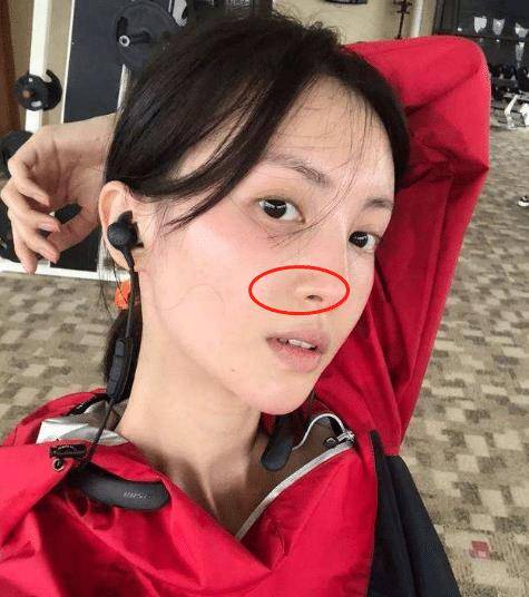 黑头|金晨是牛奶“泡大”的？穿吊带裙藏不住“水光肌”皮肤嫩得要出水