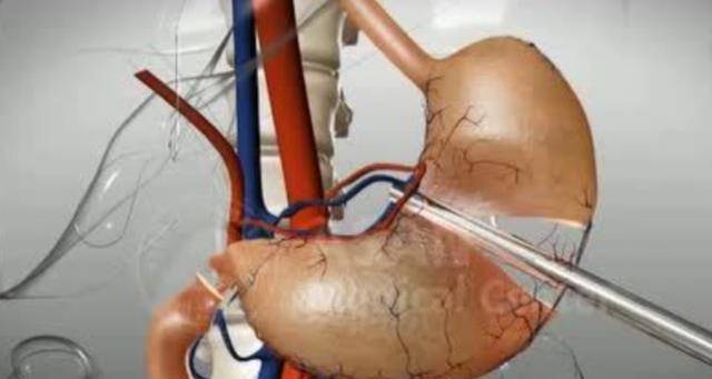 生活|人体的八个器官或可以“拿掉”，且不会影响正常生活，是真的吗？