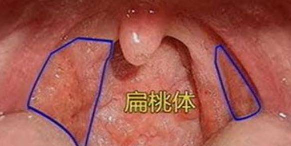 生活|人体的八个器官或可以“拿掉”，且不会影响正常生活，是真的吗？