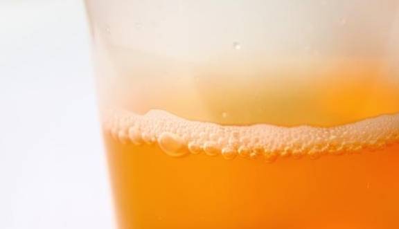 诊断|蛋白尿难消除有6个原因,医生给肾友3条建议,收藏