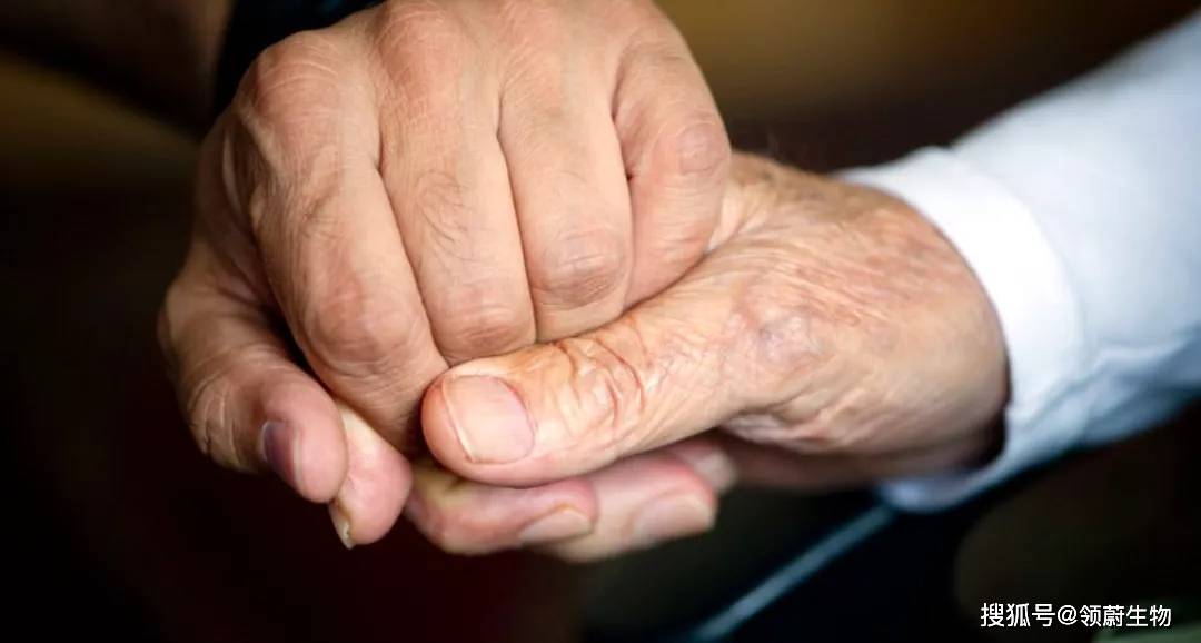 肝脏|阿尔兹海默病新突破!肝脏中的淀粉样蛋白会通过血液损害大脑