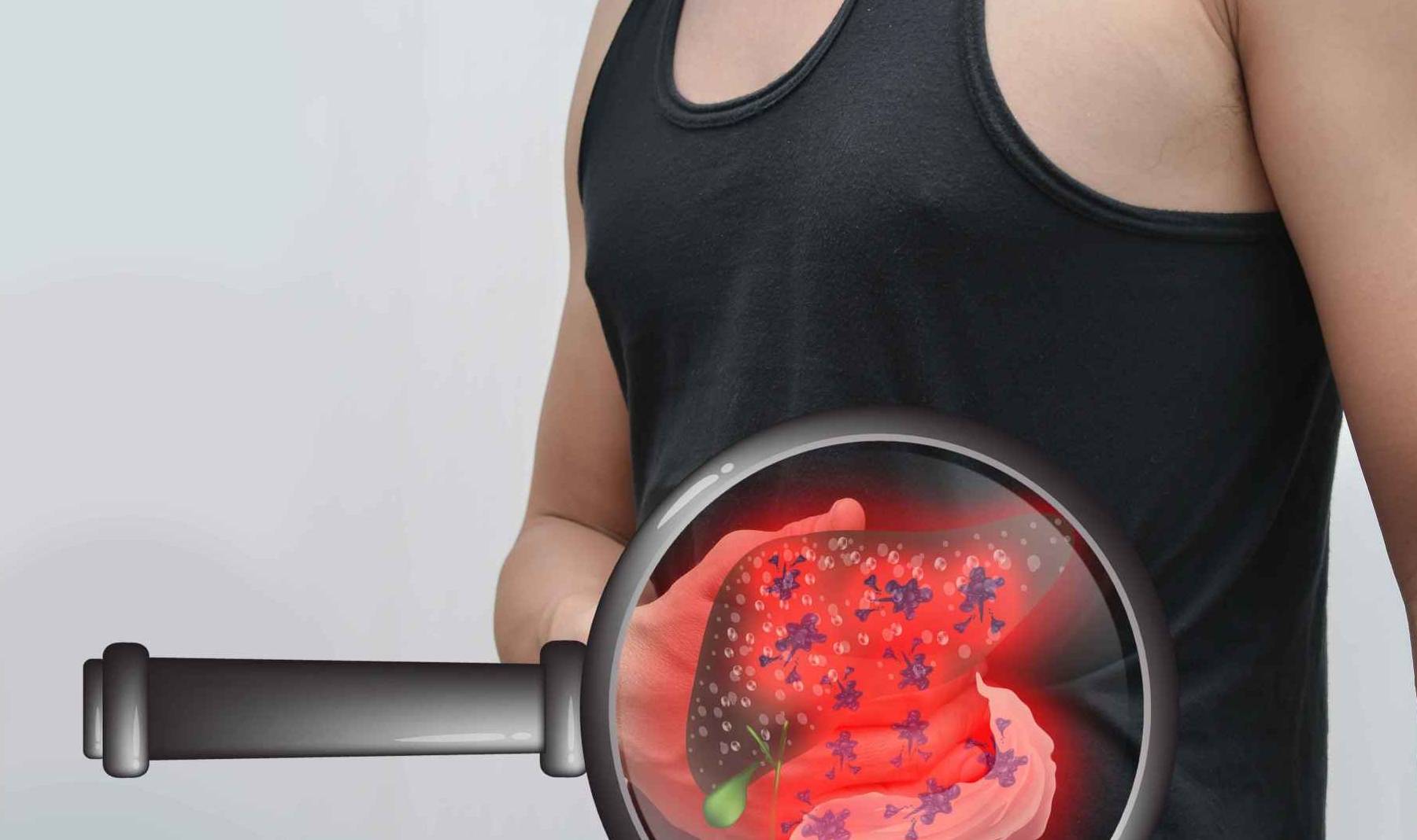 症状|身体出现5个异常信号,立即排查肝病,警惕肝硬化早期发生