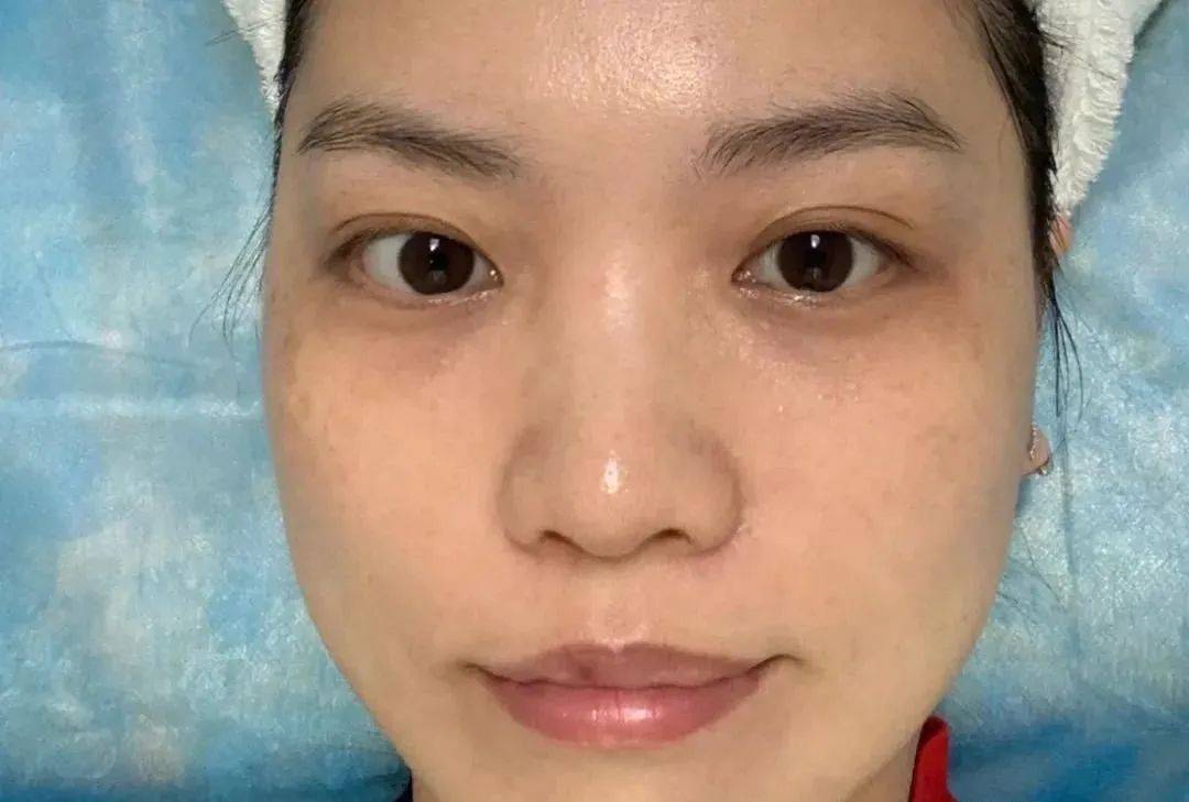 方法有效美白vs无效美白，为什么你的美白没有用？