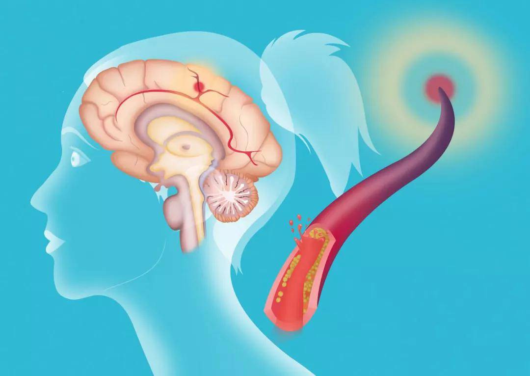 建议|洗澡不当 15岁女孩进ICU 医生支招：秋季洗澡的正确打开方式