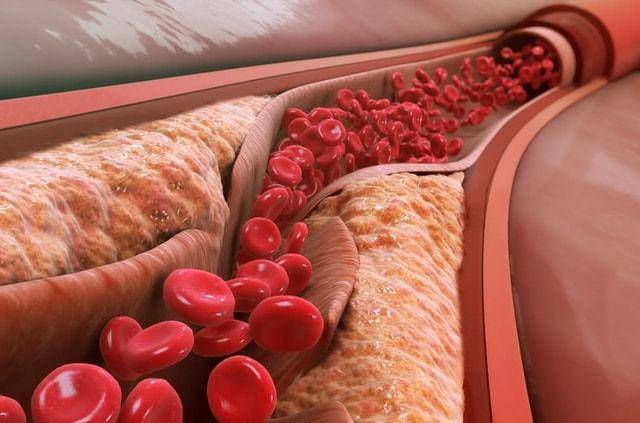 变化|胰岛“保护伞”已找到，不是洋葱，日常紧着吃，血糖或降低