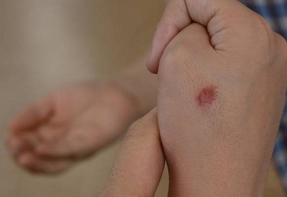 都亮|肝脏有这3个“信号灯”,都亮起来的时候,代表肝不太好