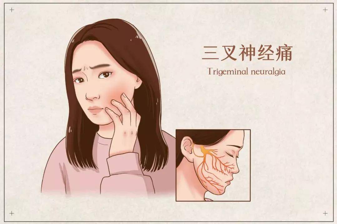 部位|很常见的头痛，却迟迟找不到“源头”，最后结果出乎意料！