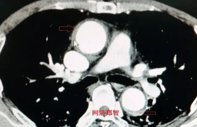 64ef0d19e27143c993fb4b9f0148f345.png