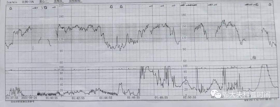 住院|妈妈安全，孩子优先，在产科，你永远不知道下一步会遇上什么坑！