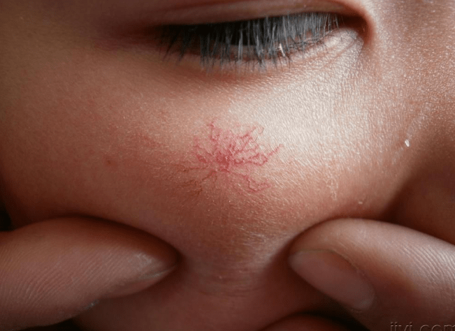 沉默|肝脏是最“沉默”的器官！一旦出问题，皮肤会出现这2个恐怖变化